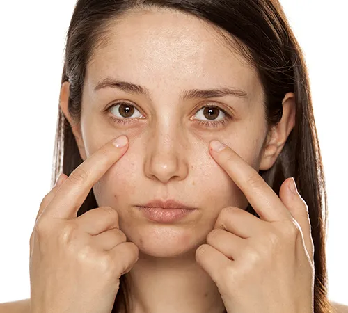 Laser Hair Removal Treatment